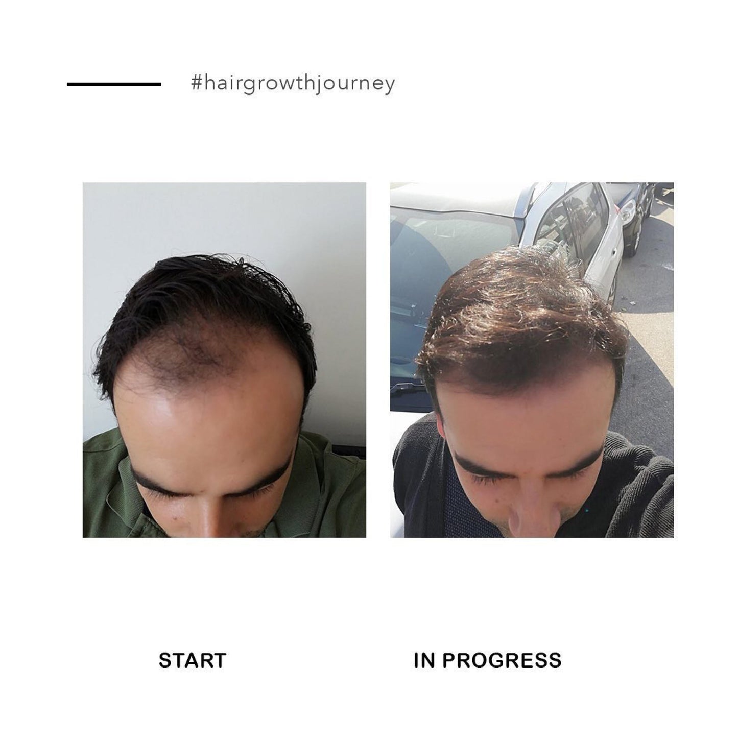 The Hair Growth Serum | For Men