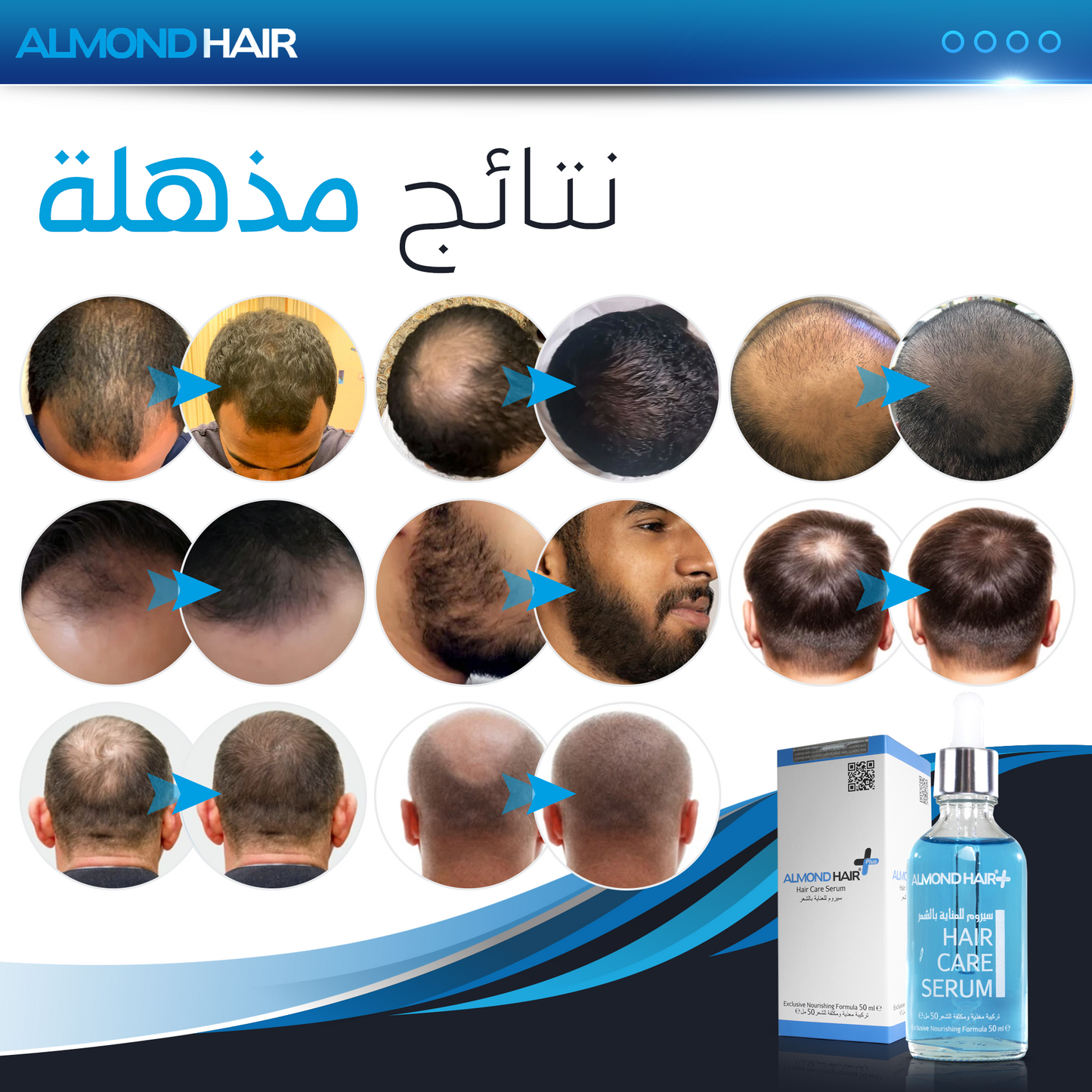 The Hair Growth Serum | For Men